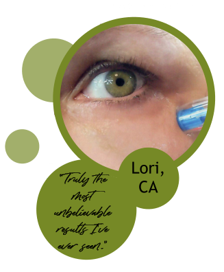Lori, CA